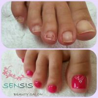 fix_broken_nail